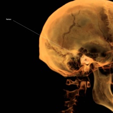 Cephalometrics